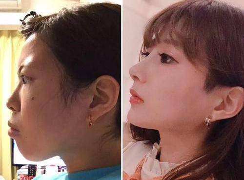 对比六旬大妈为变赵雅芝，不惜花两百万整容10次，前后对比照笑了