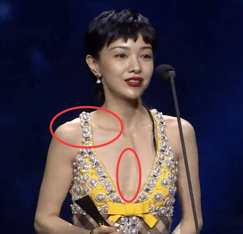 因为瘦脱相的10位女星：皮肉流失，行走的骷髅，瘦成纸片人真的不好看