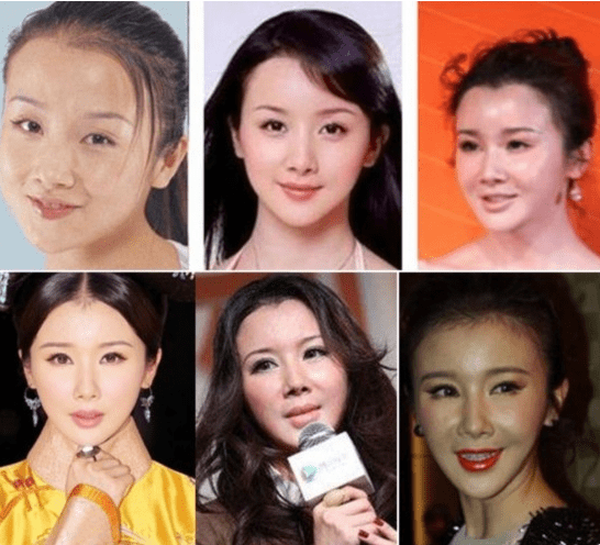 名字面部“爆改”后的7位女星，不说名字你还能认出来吗？