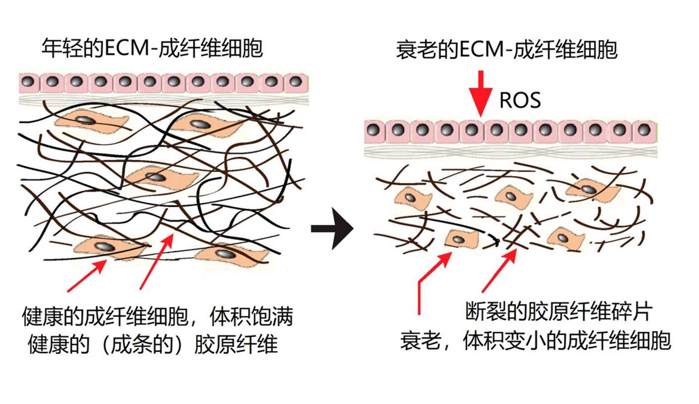 方法脸上出现木偶纹、法令纹怎么办？5个日常保养方法预防纹路加深