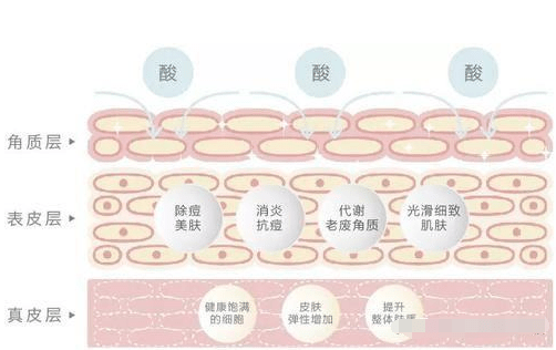 黑头鼻子出油多而且经常长粉刺，佰花方祛斑是真的吗？