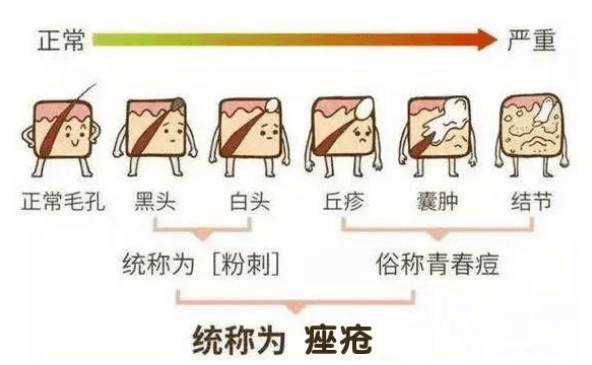 黑头黑头粉刺怎么去，这几招还你干净平滑的脸！