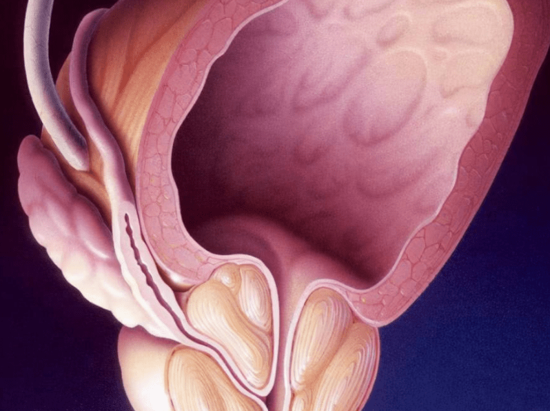 前列腺最怕3件事,你若傻傻常做,炎症會步步緊逼_男性_生活_個人
