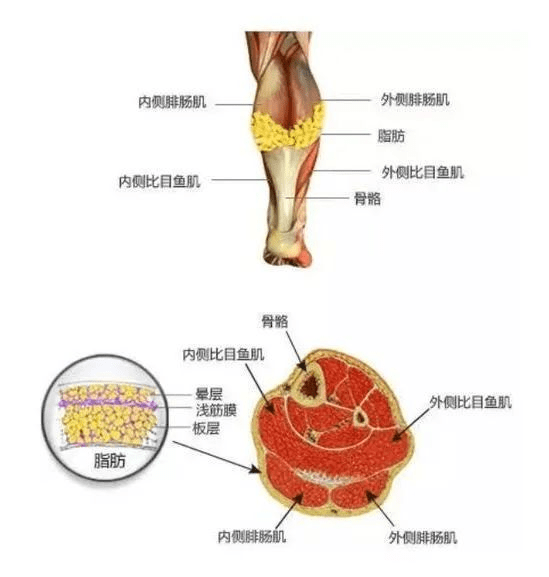 腿肚子肌肉图片