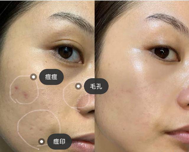 化妆品59岁英国女子靠“整容”抗老，连续抽脂30多次，现在怎么样了