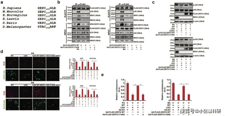 小结:ddit4 s-亚硝化后可以整合进p38-mapk信号复合体中,其s-亚硝化位