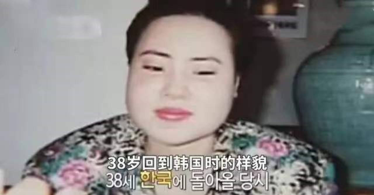 因为女星韩慧景：为了更漂亮，给脸注射食用油，把脸整成“猪头”