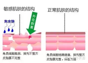 因为敷面膜的十大误区，你都干了几件？