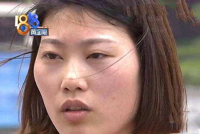 要求女子花3万整眼睛，做完手术后怒曝光：我晚上睡觉眼睛都闭不上！