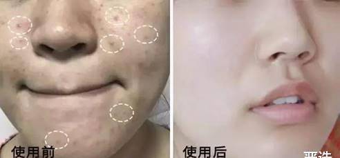 仁和北大医学博士：答应我，不要再买这些含“剧”的化妆品了！