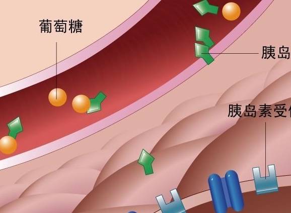 空腹|血糖高就一定是糖尿病吗？