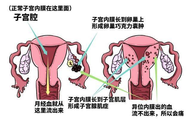 女人子宫肚子图片