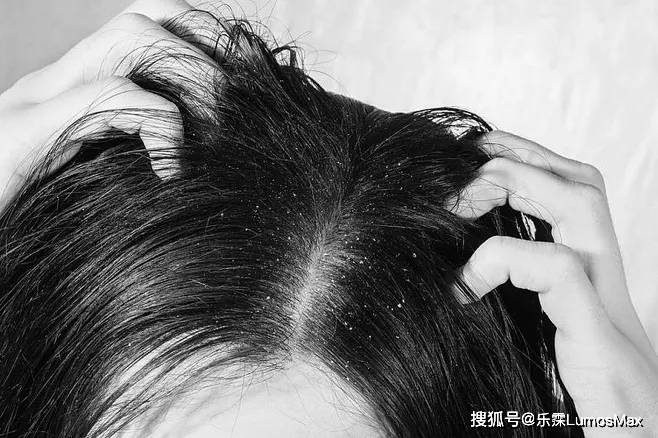 方法换季头发一掉一大把？别急，这些小方法“拯救”你！