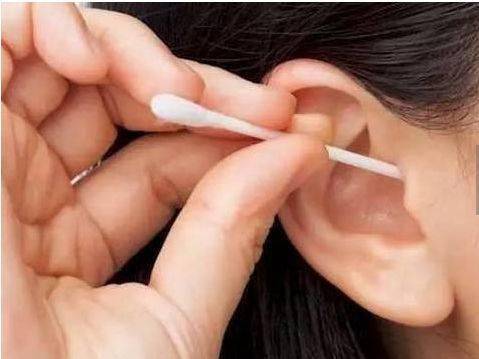 听力|耳垢需要经常掏吗？