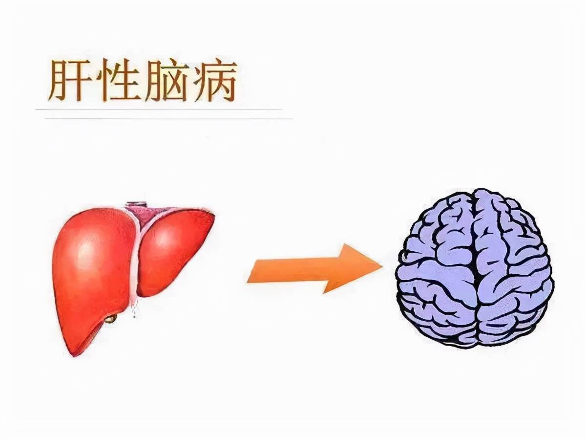 酒精肝不控制會帶來哪些後果