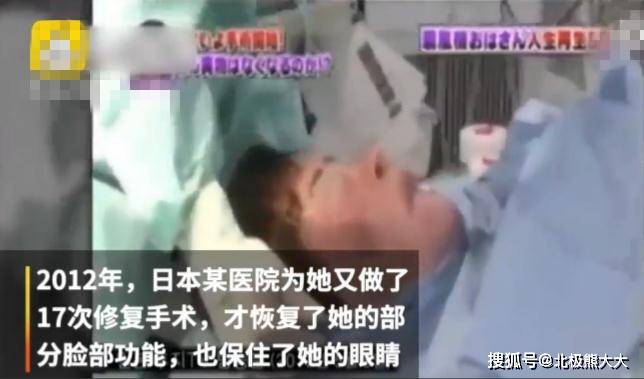 因为痴迷整容15年，把脸整成“电风扇”后遗症明显，韩慧景后悔了吗？