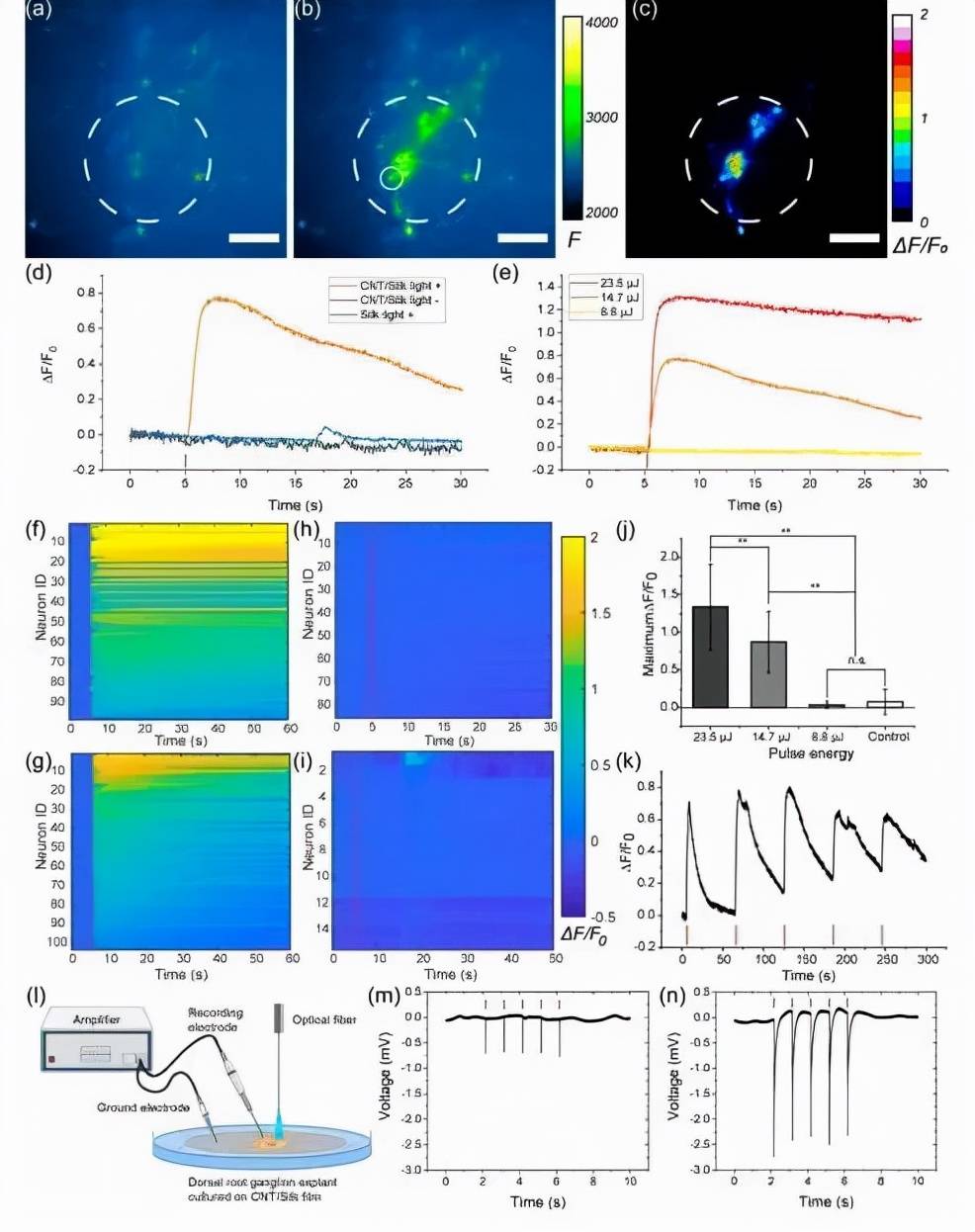 波士顿大学团队提出新型丝素蛋白支架,可用于视力矫正及脑机接口