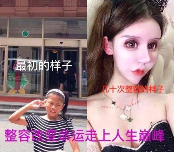 漂亮那个13岁就整容的网红女孩，3年整了60次，如今现状如何？