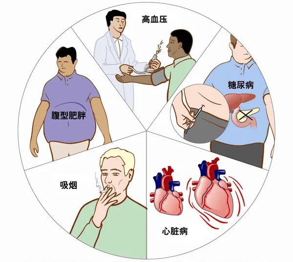 控制|“卒”不及防？看看哪些人容易脑卒中