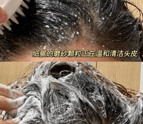方法染头发把头皮伤了，后面还怎么洗头？！