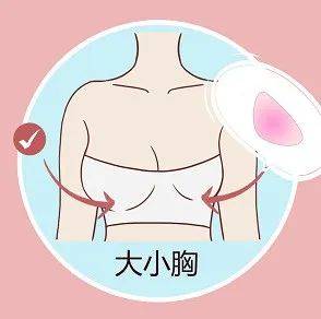 在青春期发育时期,两侧乳房对于激素的接收程度不同,从而导致左右胸部