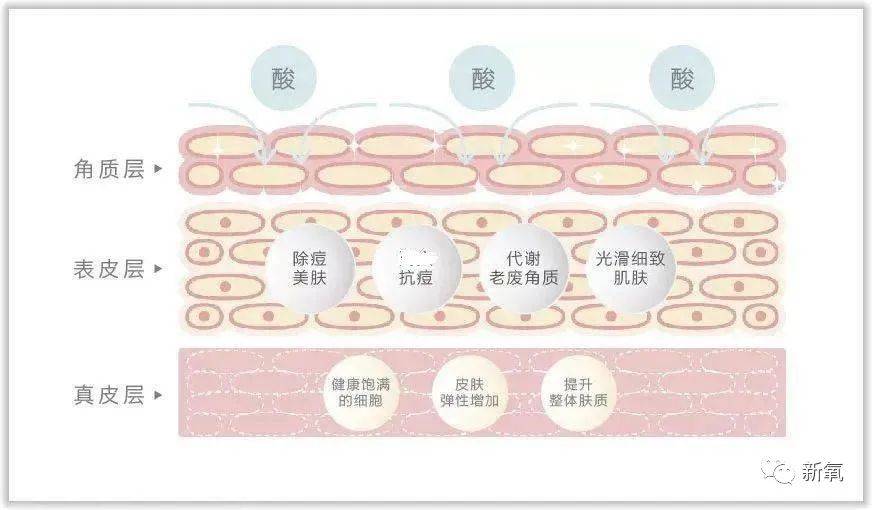 因为安妮海瑟薇是怎么回春的？