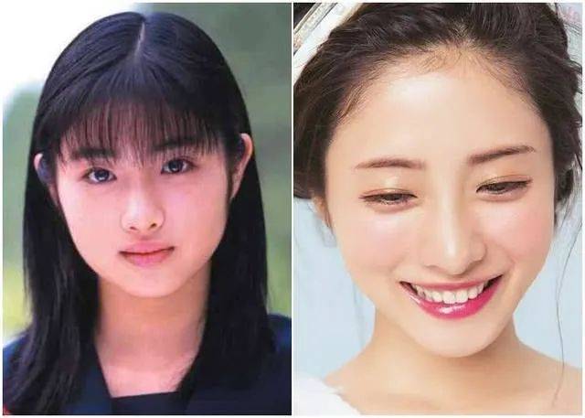 视觉面部高差如何影响面部视觉重心,继而影响整体美感?
