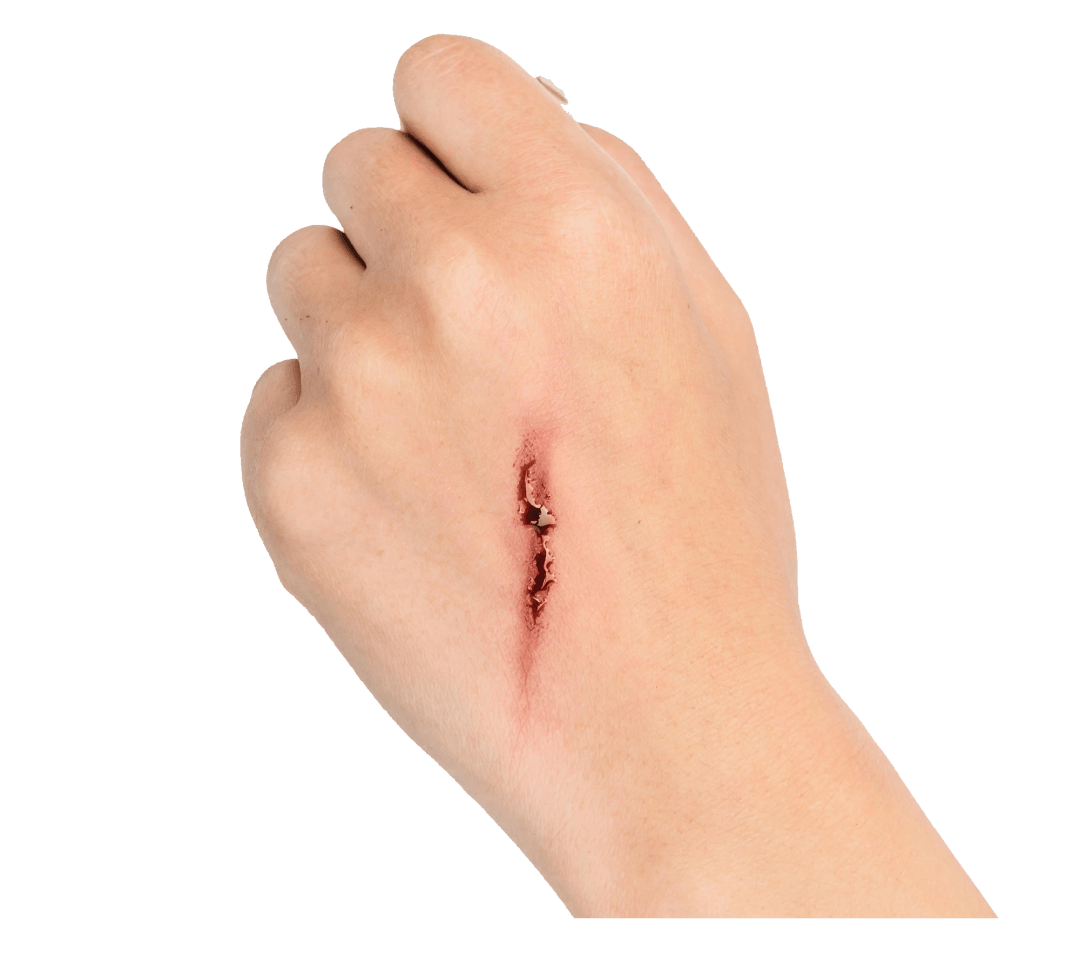 伤口的家庭护理与常备药品医维康带你了解