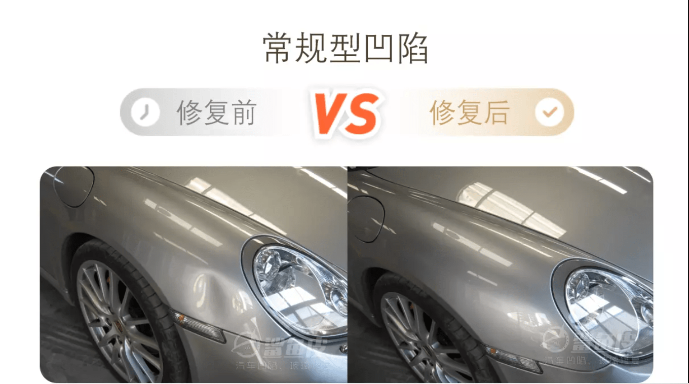 「」行业的革新：从凹陷修复到全面焕新