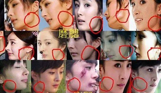 脸部明星整牙后遗症：杨幂脸部松弛，王嘉尔颧骨外扩，宋祖儿法令纹深！！