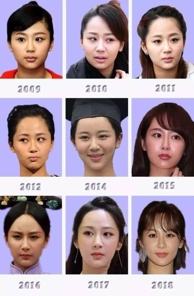 下巴整前似大妈、整完变少女？这些“回炉重造”的女明星，太成功了！
