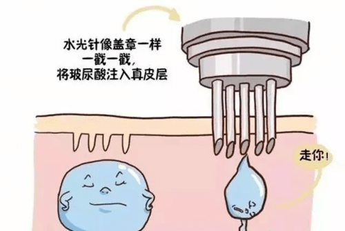 空气怎样改善春季皮肤敏感?长沙星城丽格教你从这几方面入手