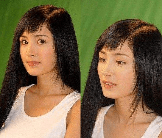 下巴整前似大妈、整完变少女？这些“回炉重造”的女明星，太成功了！
