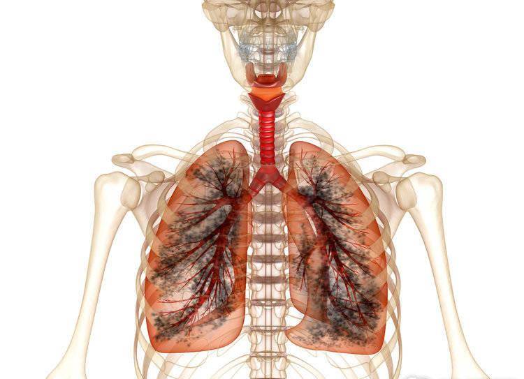 抽烟3年的肺部照片图片