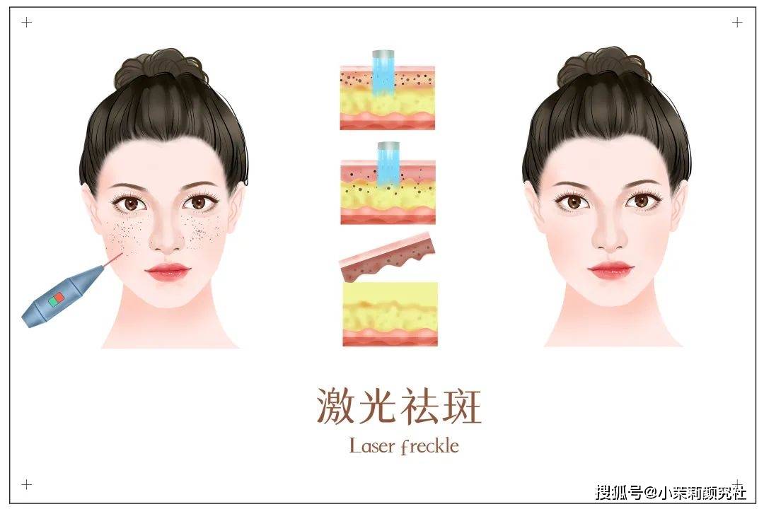 表皮层爱长斑的女生，除了淡斑精华，你还可以...