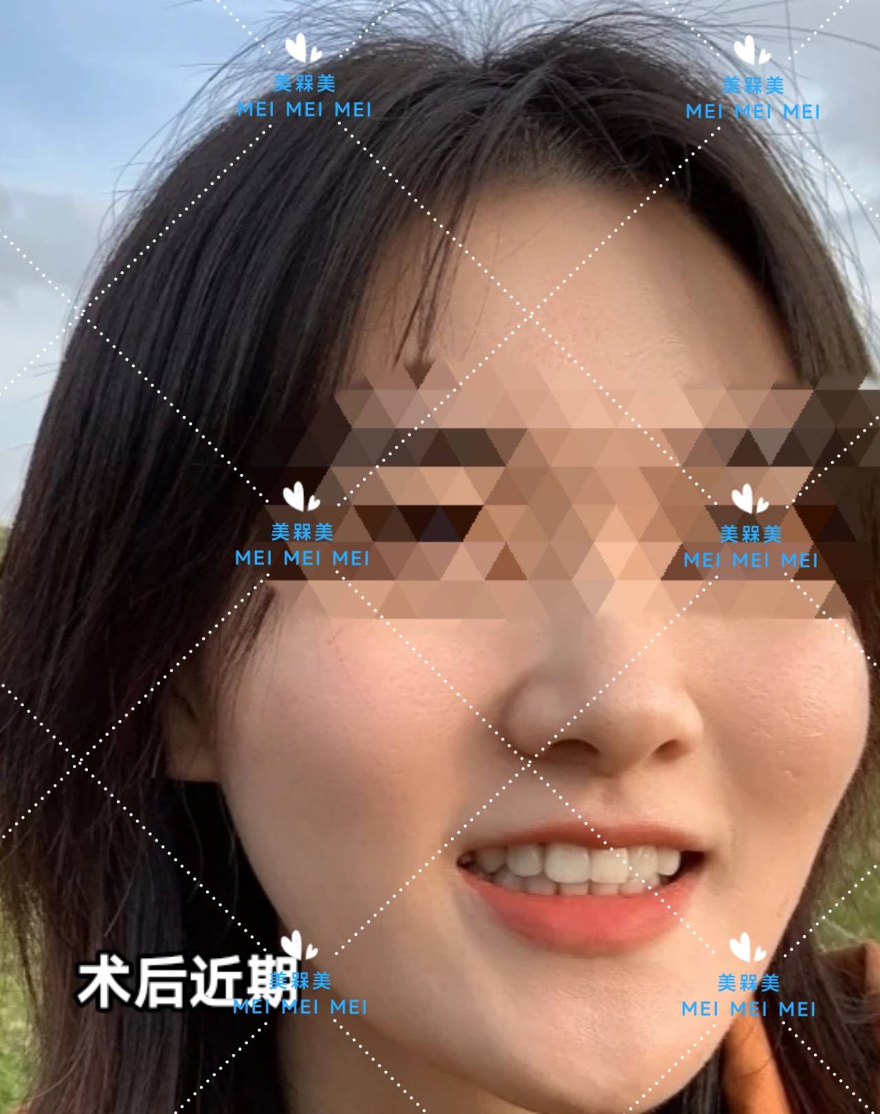 差不多【美人汇】痘痘肌少女的逆袭之路