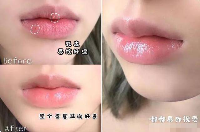 因为警惕：改善这四个“坏习惯”，否则唇部起皮干裂，你是否中招了？