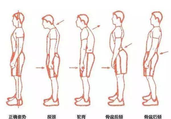 如何变好体态 86e71476205a4324a8d69e5c4f5ac021.jpeg