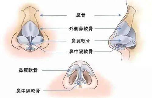 变形关于隆鼻选择那种材料比较好