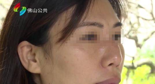 万先生佛山女子花5万想整成“旺夫”相，术后崩溃了：鼻子歪成“S”型！