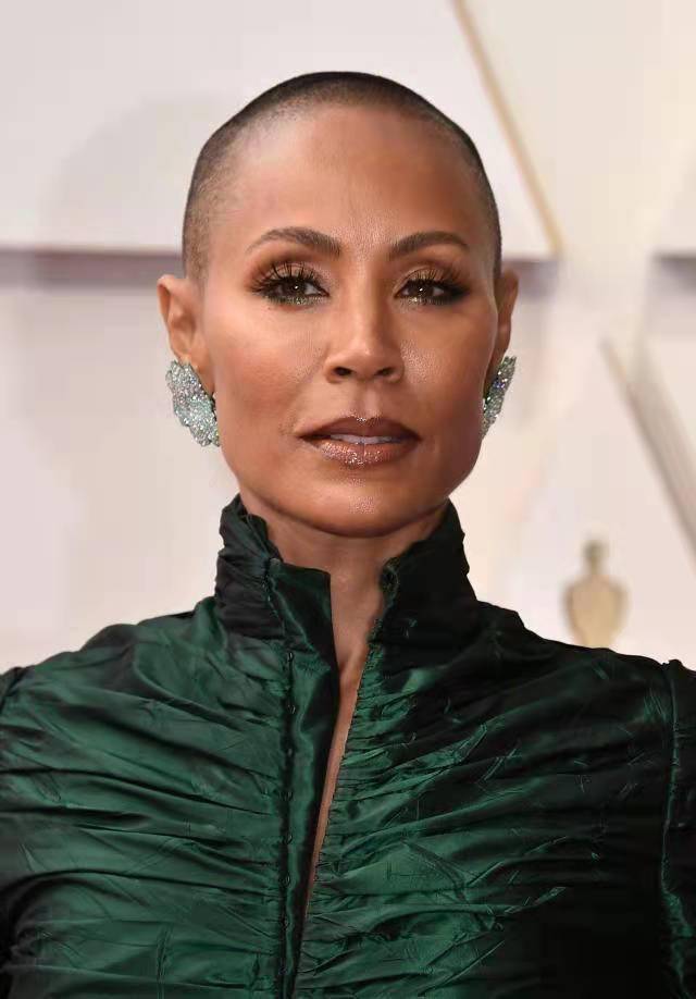 威尔·史密斯的妻子——贾达·萍克特·史密斯(jada smith)的脱发症