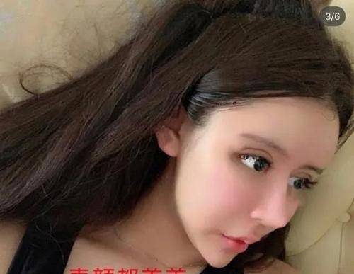 我国还记得3年花费百万，整容60次的“芭比娃娃”吗？前后判若两人