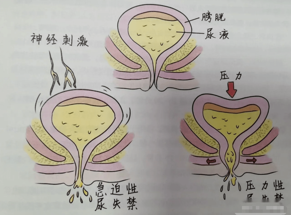 孕期这些“尴尬事”，个个都让准妈妈不适，教你如何轻松化解