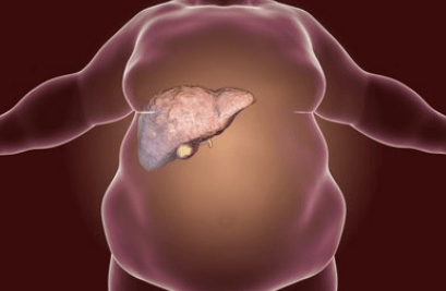 医生建议:想要稳定肝脏,3种水果要多吃_养肝_脂肪酸_人体