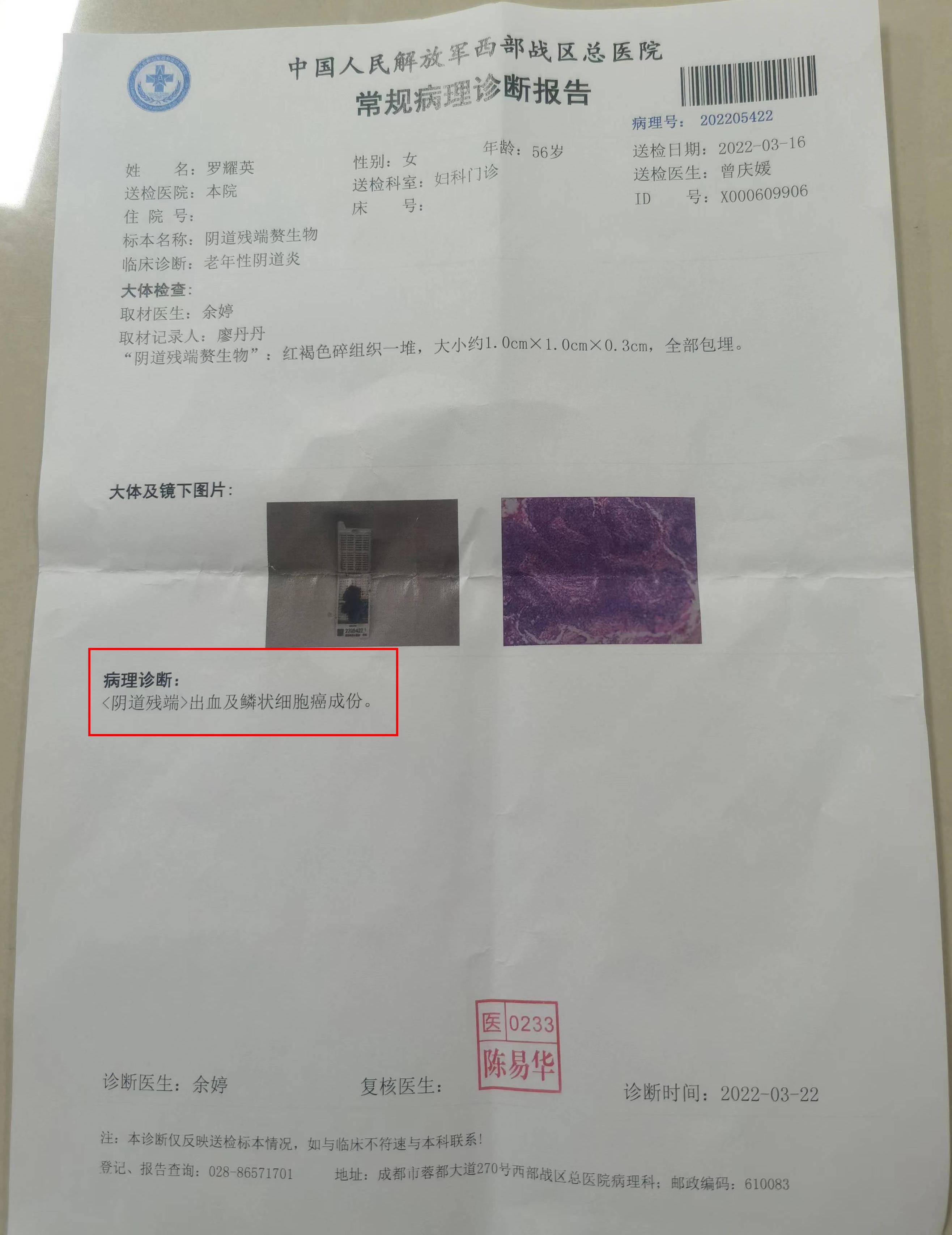 四川57岁单亲母亲患癌!