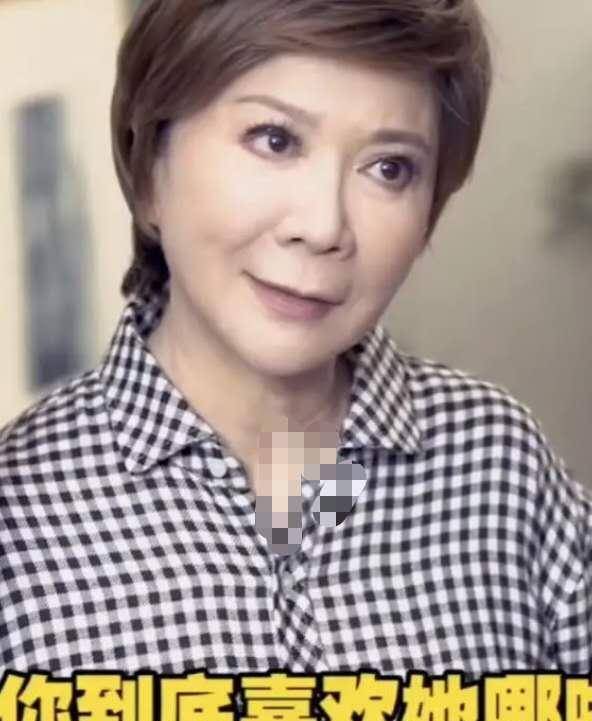 59岁蔡明近照曝光脸部浮肿不自然与以往精致状态差别大