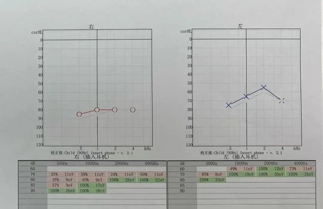 重慶惠耳聽力助聽器3歲小朋友唯聽智擎330助聽器選配案例