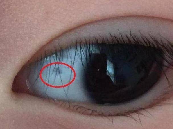 原创为啥孩子的眼白有黑点不是被吓到了多半与这三个原因有关