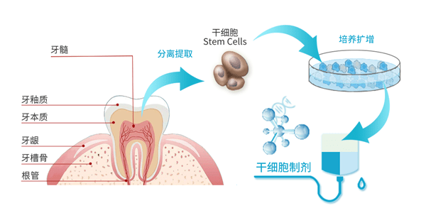 赛尔再生医学分享牙髓干细胞来源——智齿是一巨大宝库