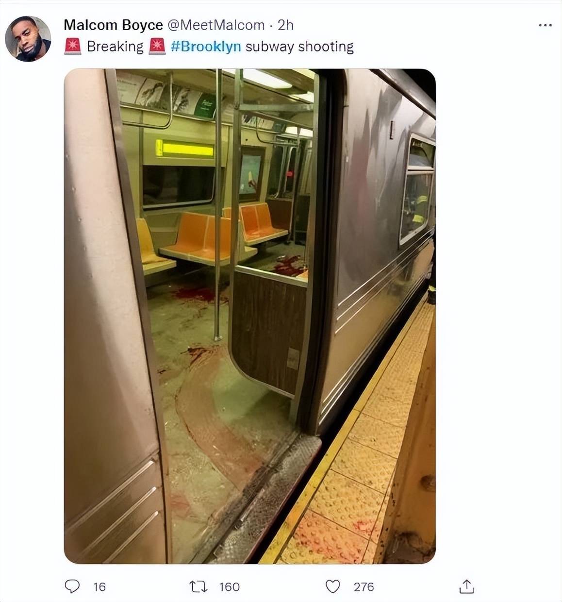 纽约死亡地铁枪案致28伤多名亚裔中弹华人后怕差点没命